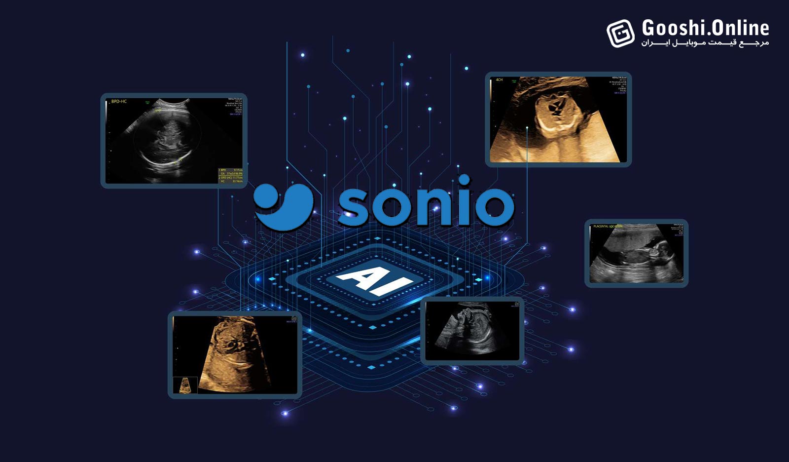 سامسونگ با خرید Sonio به دنیای هوش مصنوعی پزشکی قدم گذاشت